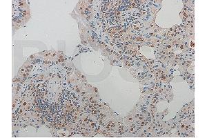 Formalin-fixed and paraffin-embedded rat aortic tissue labeled with Rabbit Anti-NFKB p65 Polyclonal Antibody (ABIN668961), Unconjugated at 1:600 followed by conjugation to the secondary antibody and DAB staining (NF-kB p65 antibody  (AA 51-100))