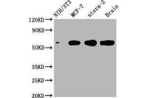 Western Blot Positive WB detected in: NIH/3T3 whole cell lysate, MCF-7 whole cell lysate, ntera-2 whole cell lysate, Mouse brain tissue All lanes: PAK1 antibody at 1:2000 Secondary Goat polyclonal to rabbit IgG at 1/50000 dilution Predicted band size: 61, 62 kDa Observed band size: 61 kDa (Recombinant PAK1 antibody)