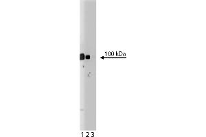 Western Blotting (WB) image for anti-Plakophilin 2 (PKP2) (AA 19-183) antibody (ABIN968178) (Plakophilin 2 antibody  (AA 19-183))