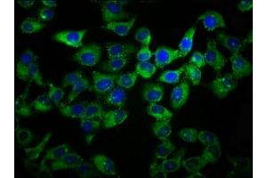 Immunofluorescence staining of Hela cells with ABIN7164489 at 1:133, counter-stained with DAPI.