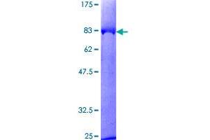 KNG1 Protein (AA 1-427) (GST tag)