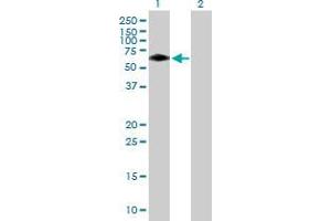 Lane 1: BTBD10 transfected lysate ( 53. (BTBD10 293T Cell Transient Overexpression Lysate(Denatured))