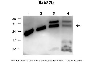 WB Suggested Anti-Rab27b Antibody Titration: 0.
