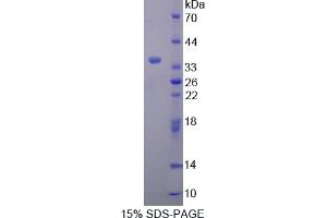 Image no. 1 for Secretagogin, EF-Hand Calcium Binding Protein (SCGN) (AA 1-276) protein (His tag) (ABIN6237189)