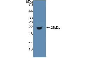 Detection of Recombinant MHCDG, Human using Polyclonal Antibody to Cluster Of Differentiation 74 (CD74) (CD74 antibody  (AA 64-205))