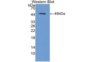 Detection of Recombinant FASL, Mouse using Polyclonal Antibody to Factor Related Apoptosis Ligand (FASL) (FASL antibody  (AA 132-279))