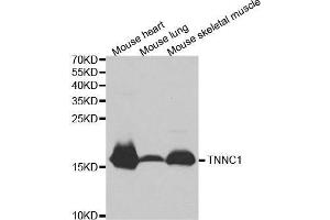 Western blot analysis of extracts of various cell lines, using TNNC1 antibody. (TNNC1 antibody  (AA 1-160))