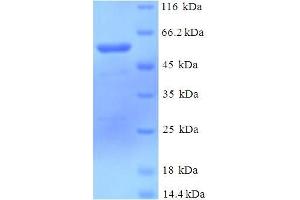 SDS-PAGE (SDS) image for DDB1 and CUL4 Associated Factor 7 (DCAF7) (AA 1-342), (full length) protein (His-SUMO Tag) (ABIN5710620)