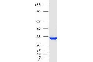 Validation with Western Blot (KCNRG Protein (Transcript Variant 1) (Myc-DYKDDDDK Tag))