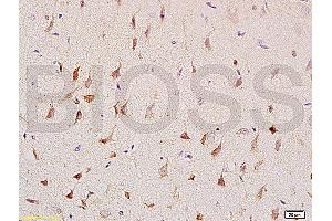 Formalin-fixed and paraffin embedded: rat brain tissue labeled with Anti-CNP/CNPase Polyclonal Antibody (ABIN730738), Unconjugated at 1:200, followed by conjugation to the secondary antibody and DAB staining