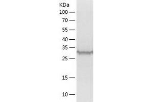 Western Blotting (WB) image for Mitochondrial Trans-2-Enoyl-CoA Reductase (MECR) (AA 54-373) protein (His tag) (ABIN7123988)