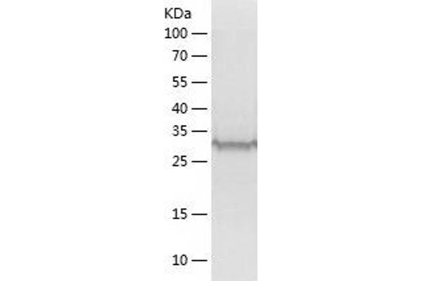 MECR Protein (AA 54-373) (His tag)