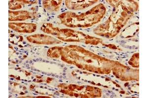 Immunohistochemistry of paraffin-embedded human kidney tissue using ABIN7163258 at dilution of 1:100 (PCK1 antibody  (AA 1-622))