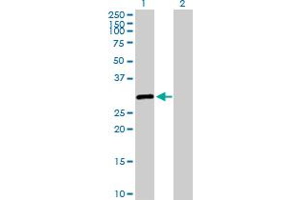 SALL2 antibody  (AA 1-198)