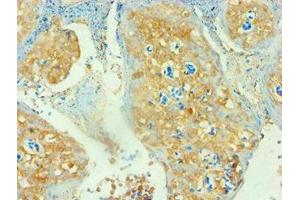 Immunohistochemistry of paraffin-embedded human tonsil tissue using ABIN7171381 at dilution of 1: 100 (CD3D antibody  (AA 22-105))
