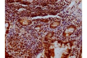 Immunohistochemistry (IHC) image for anti-Kruppel-Like Factor 4 (Gut) (KLF4) antibody (ABIN7127591)