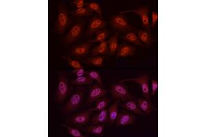 Immunofluorescence analysis of HeLa cells using WTAP Rabbit pAb (ABIN7271372) at dilution of 1:50 (40x lens).