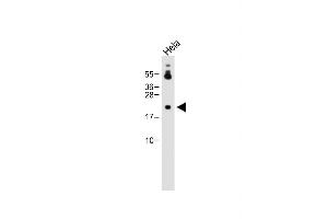 Anti-DDIT4 Antibody (N-term) at 1:2000 dilution + Hela whole cell lysate Lysates/proteins at 20 μg per lane. (DDIT4 antibody  (N-Term))