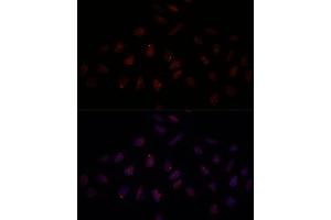 Immunofluorescence analysis of U-2 OS cells using BRC antibody (1318) at dilution of 1:100. (BRCA1 antibody  (AA 400-699))