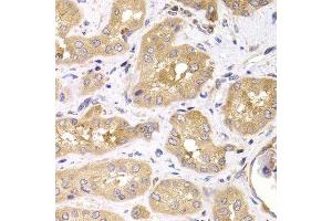 Immunohistochemistry of paraffin-embedded human kidney using RPS4X antibody. (RPS4X antibody  (AA 66-263))