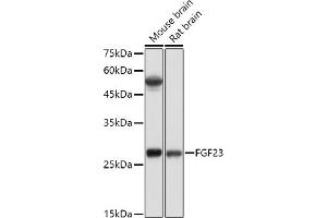 Western blot analysis of extracts of various cell lines, using FGF23 antibody (ABIN6127894, ABIN6140600, ABIN6140602 and ABIN6221721) at 1:500 dilution. (FGF23 antibody  (AA 25-251))