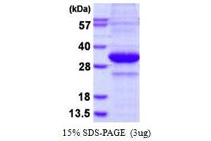 Image no. 1 for Prostate Specific Antigen (PSA) protein (His tag) (ABIN1098657) (Prostate Specific Antigen Protein (PSA) (His tag))