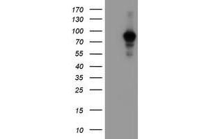 HEK293T cells were transfected with the pCMV6-ENTRY control (Left lane) or pCMV6-ENTRY ATRIP (Right lane) cDNA for 48 hrs and lysed. (ATRIP antibody  (AA 42-309))