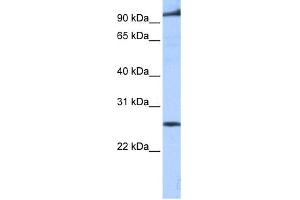 WB Suggested Anti-PPAPDC1B Antibody Titration:  0. (PPAPDC1B antibody  (Middle Region))