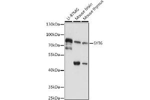 Western blot analysis of extracts of various cell lines, using SYT6 antibody (ABIN7270677) at 1:1000 dilution. (SYT6 antibody  (AA 1-120))