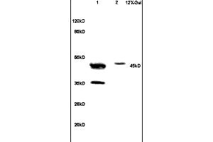 Lane 1: human colon carcinoma lysates Lane 2: mouse brain lysates probed with Anti NCF1/p47 phox Polyclonal Antibody, Unconjugated (ABIN750643) at 1:200 in 4 °C. (NCF1 antibody  (AA 151-250))