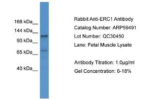 WB Suggested Anti-ERC1  Antibody Titration: 0. (ERC1 antibody  (C-Term))