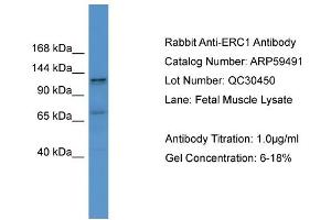 WB Suggested Anti-ERC1  Antibody Titration: 0.
