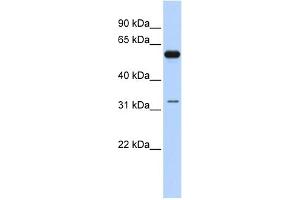 WB Suggested Anti-DDX28 Antibody Titration:  0.