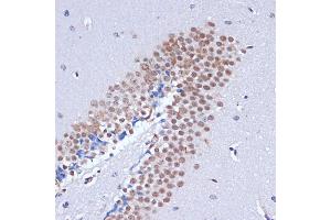 Immunohistochemistry of paraffin-embedded mouse brain using DNMT3L antibody (ABIN3023228, ABIN3023229, ABIN3023230 and ABIN6219498) at dilution of 1:100 (40x lens). (DNMT3L antibody  (AA 1-386))