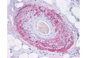 Anti-Ghrelin Receptor antibody IHC of human skin, hair follicle. (GHSR antibody  (Internal Region))