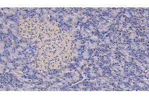 Detection of IL1RA in Human Pancreas Tissue using Monoclonal Antibody to Interleukin 1 Receptor Antagonist (IL1RA) (IL1RN antibody  (AA 26-177))