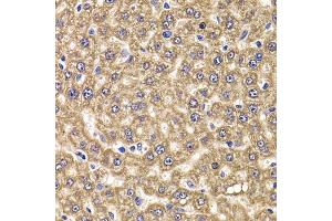 Immunohistochemistry of paraffin-embedded rat liver using UBE2J2 antibody (ABIN5974418) at dilution of 1/100 (40x lens). (UBE2J2 antibody)