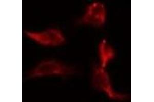 ABIN6278357 staining Hela by IF/ICC. (CARD9 antibody  (C-Term))