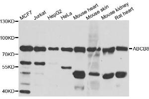 Western blot analysis of extracts of various cell lines, using ABCB8 antibody (ABIN5974712) at 1/1000 dilution. (ABCB8 antibody)