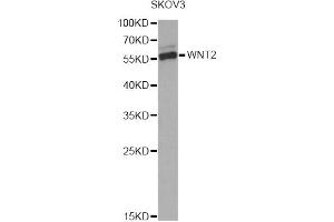 Western blot analysis of extracts of SKOV3 cells, using WNT2 Antibody. (WNT2 antibody)