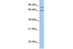 WB Suggested Anti-OXCT2 Antibody Titration:  0.