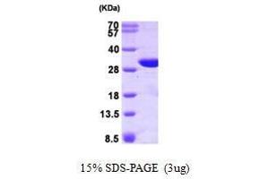 Figure annotation denotes ug of protein loaded and % gel used. (GSTO1 Protein (AA 1-241) (His tag))