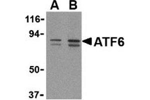Western Blotting (WB) image for anti-Activating Transcription Factor 6 (ATF6) (C-Term) antibody (ABIN1030261) (ATF6 antibody  (C-Term))