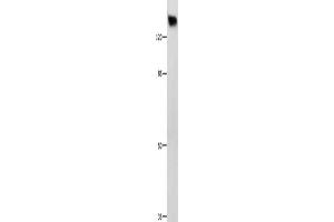 Gel: 8 % SDS-PAGE, Lysate: 60 μg, Lane: Hela cells, Primary antibody: ABIN7190883(GRM1 Antibody) at dilution 1/125, Secondary antibody: Goat anti rabbit IgG at 1/8000 dilution, Exposure time: 1 minute (Metabotropic Glutamate Receptor 1 antibody)