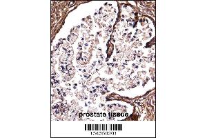 DSG2 Antibody immunohistochemistry analysis in formalin fixed and paraffin embedded human prostate tissue followed by peroxidase conjugation of the secondary antibody and DAB staining. (Desmoglein 2 antibody  (C-Term))