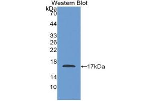 Western blot analysis of the recombinant protein. (Factor VIII antibody  (AA 1854-1989))