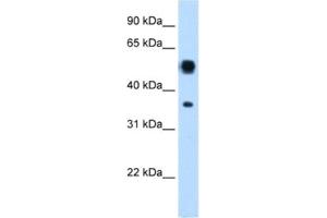 Western Blotting (WB) image for anti-Argininosuccinate Lyase (ASL) antibody (ABIN2462447) (ASL antibody)