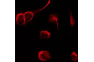 ABIN6266562 staining SKOV3 by IF/ICC. (Neuregulin 1 antibody  (N-Term))
