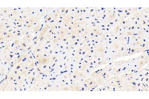 Detection of PLOD1 in Human Cardiac Muscle Tissue using Polyclonal Antibody to Procollagen Lysine-1,2-Oxoglutarate-5-Dioxygenase 1 (PLOD1) (PLOD1 antibody  (AA 636-727))