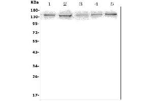 Western blot analysis of AXL using anti-AXL antibody (ABIN7601813).